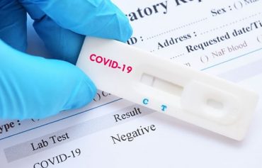COVID-19 PCR Test