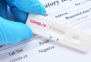 COVID-19 PCR Test